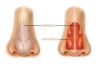 rinoplastia tabique cornetes